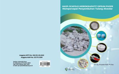 HAGP: SCAFOLD HIDROKSIAPATIT GIPSUM PUGER – Mempercepat Penyembuhan Tulang Alveolar